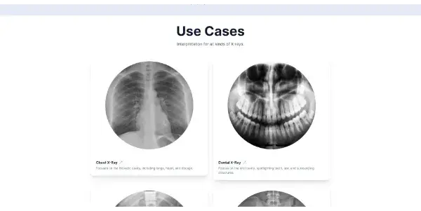 Screenshot of X-ray Interpreter